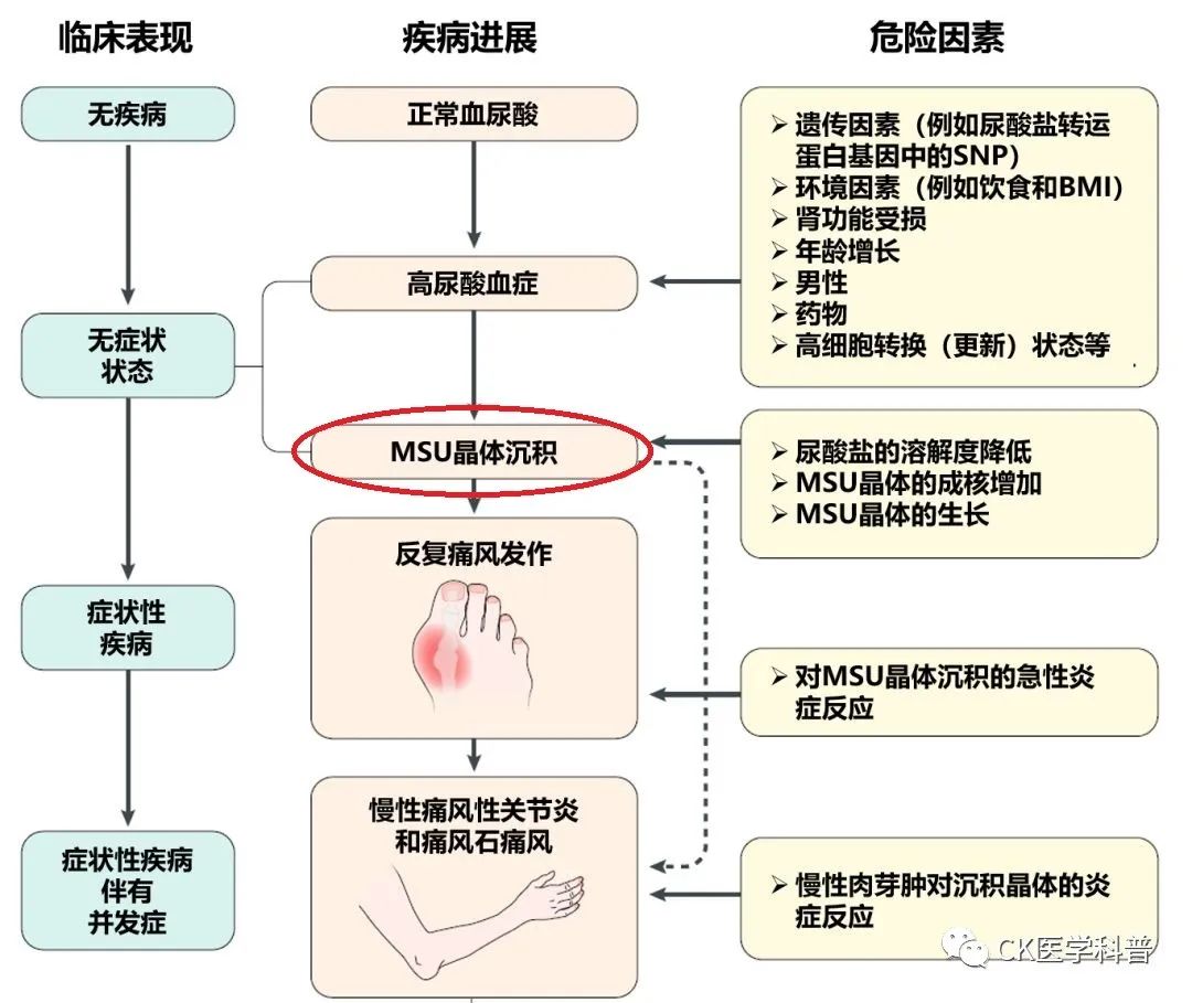 最新痛风指南，全面解析管理策略与生活方式调整助力痛风防治